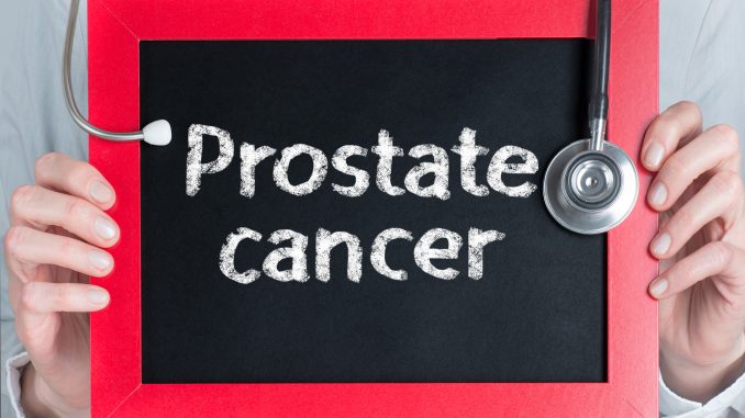 prostate cancer diagnosis treatment and support